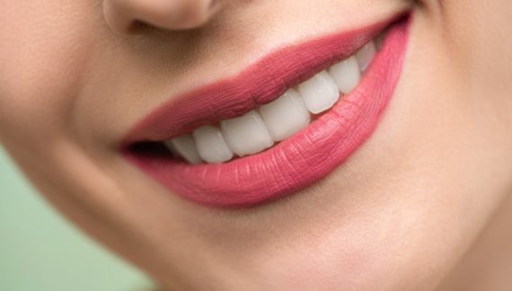 Λεύκανση Δοντιών – Τι είναι, πόσο κοστίζει και που να την κάνετε